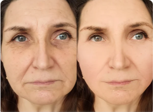 Før og etter-resultat med ScandiSkin Retinal Shot
