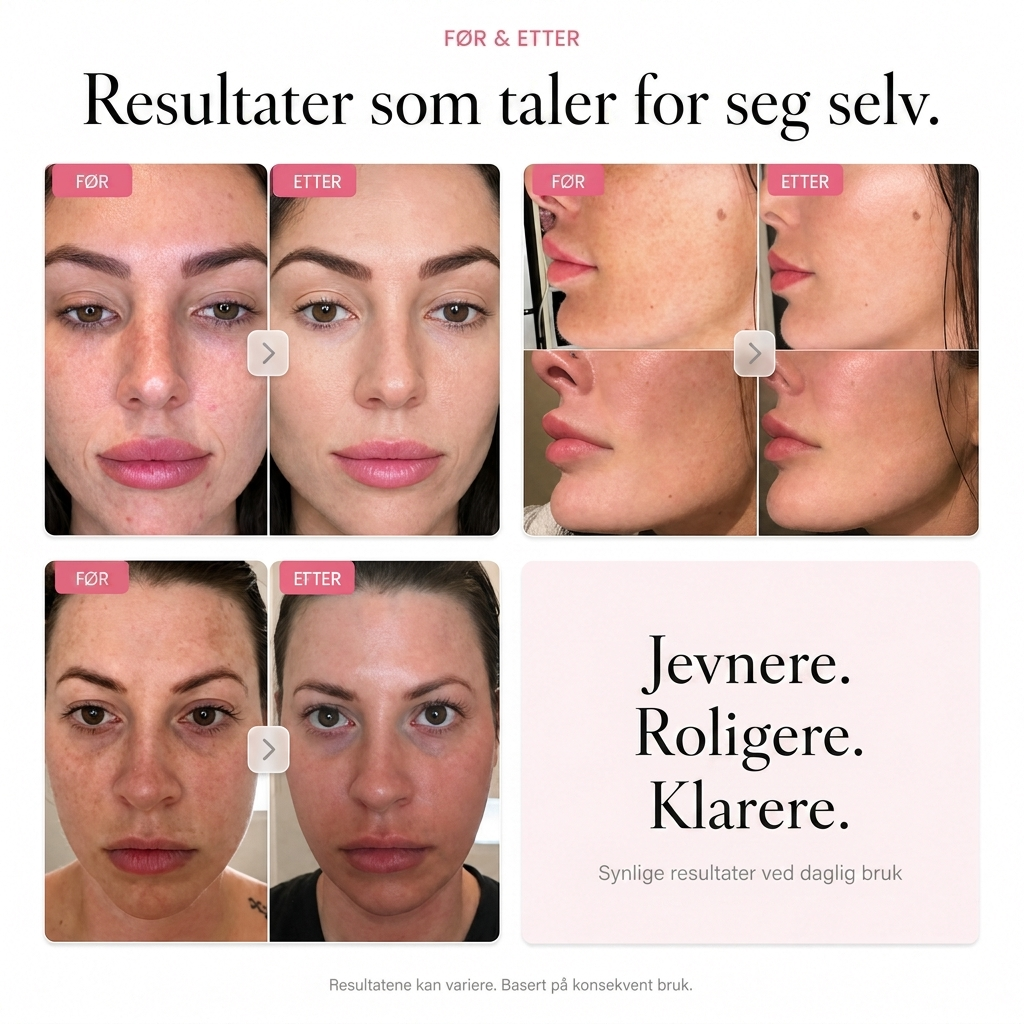 ARBUTIN 7% LYSERE HUDKREM