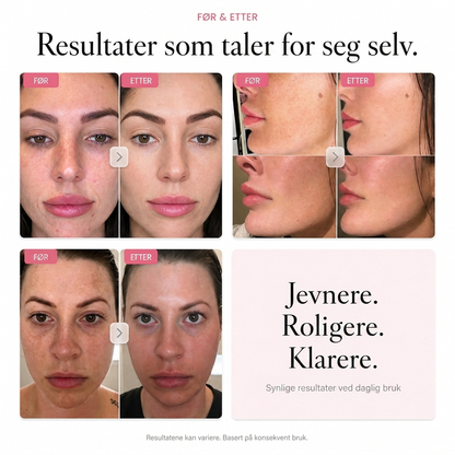ARBUTIN 7% LYSERE HUDKREM